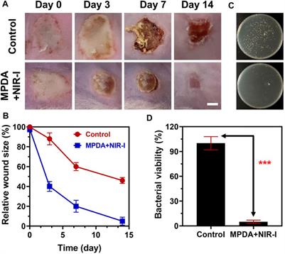 Polydopamine-based nanospheres as nanoplatforms to kill Staphylococcus aureus and to promote wound healing by photothermal therapy